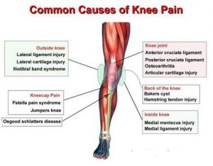Diagram showing various causes of Knee Pain